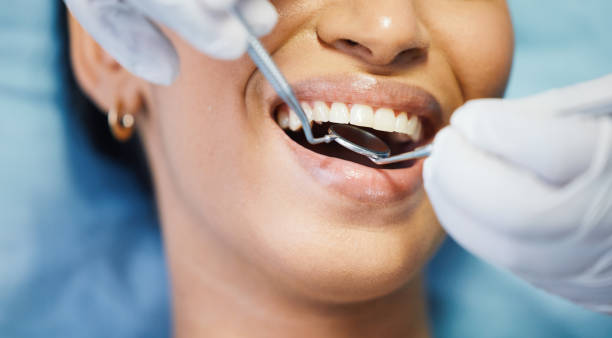 Best Emergency Tooth Extraction in Floydada, TX